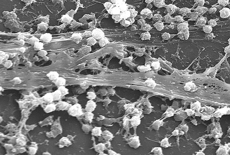 Biofilms